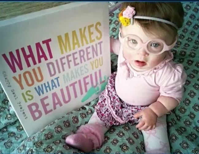 Mom of child with down syndrome starts