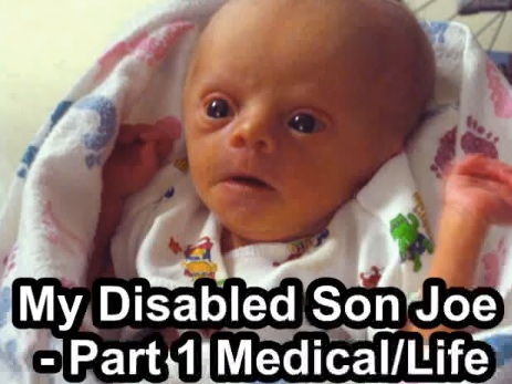 My Son Joe Tetrasomy 8p Mosaic Down Syndrome