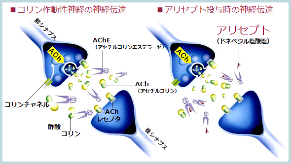 aricept