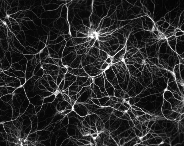 neuron1